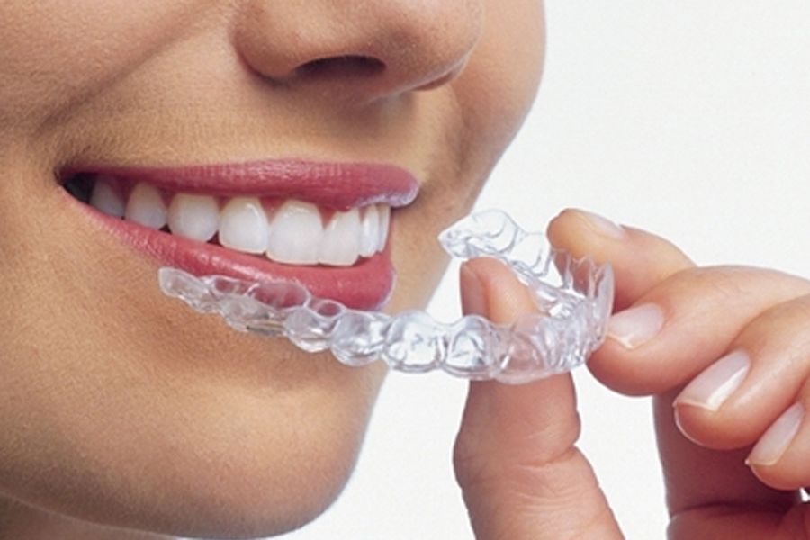 豊中市の歯医者、藤田歯科豊中ステーションクリニックの口腔内スキャナー「iTero」