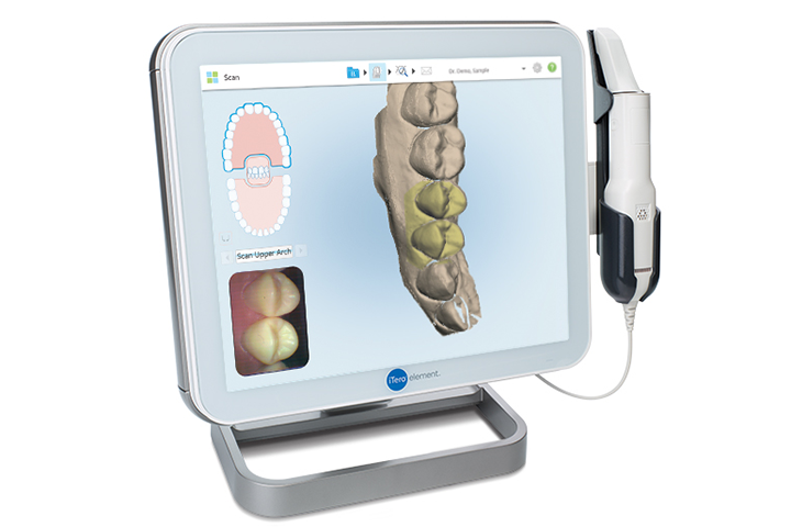豊中市の歯医者、藤田歯科豊中ステーションクリニックの口腔内スキャナー「iTero」