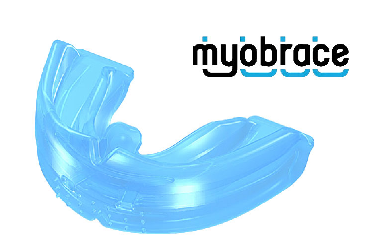 藤田歯科豊中ステーションクリニックの筋機能矯正治療(マイオブレース)