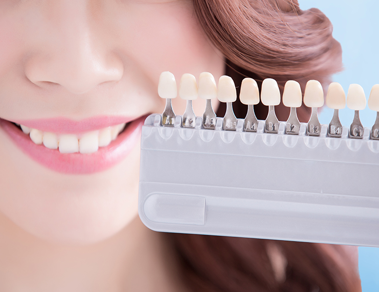 藤田歯科 豊中ステーションクリニックでホワイトニング