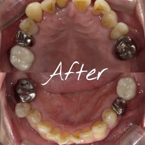 {"source_sid":"5479F296-7550-4198-9EB0-1239B3D2858F_1594793052986","subsource":"done_button","uid":"5479F296-7550-4198-9EB0-1239B3D2858F_1594793052979","source":"other","origin":"gallery"}