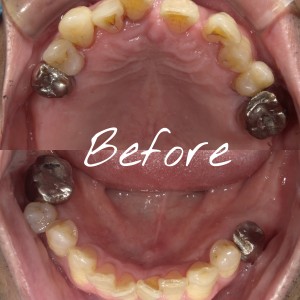 {"source_sid":"5479F296-7550-4198-9EB0-1239B3D2858F_1594792851519","subsource":"done_button","uid":"5479F296-7550-4198-9EB0-1239B3D2858F_1594792851506","source":"other","origin":"gallery"}