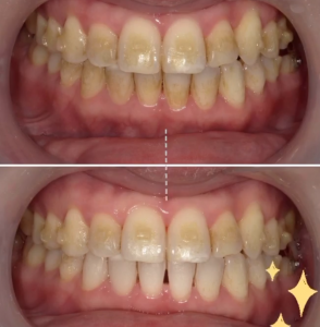 藤田歯科豊中ステーションクリニック様＿一般ブログ